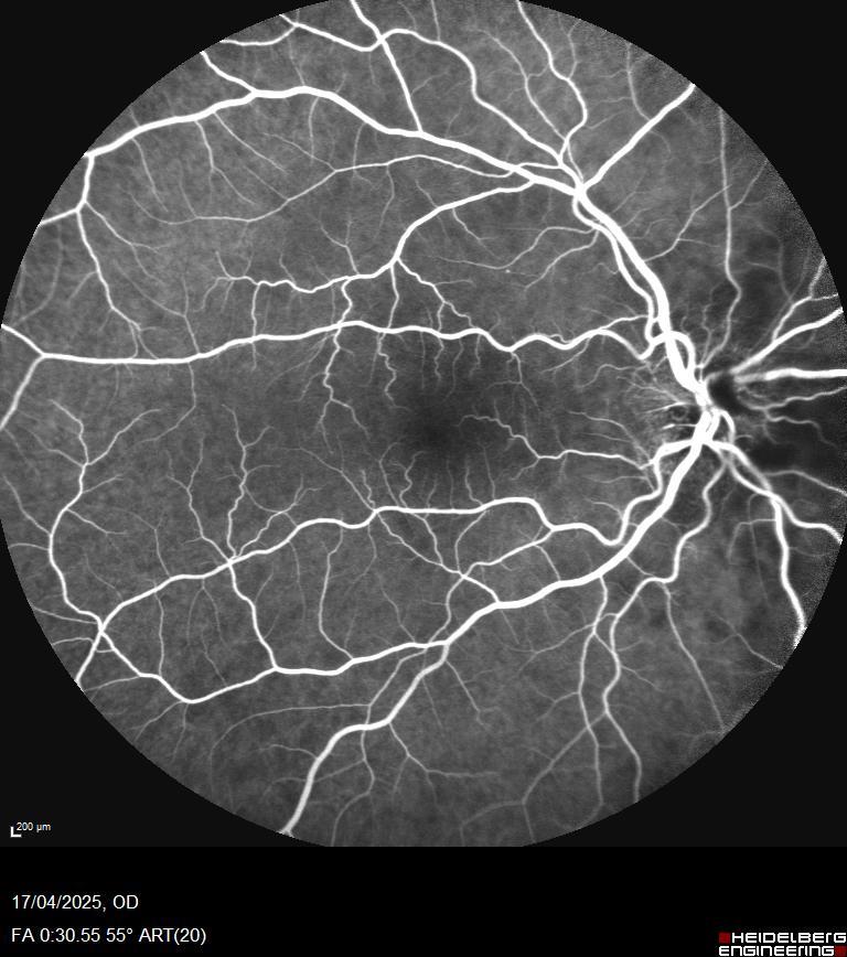 Unfortunate that the watershed area is right at the border of the photo, but the delayed filling can be recognised